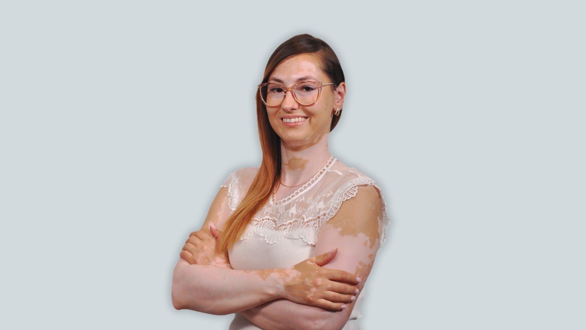 Bielactwo – czy niesie za sobą dyskomfort psychiczny, fizyczny i społeczny?